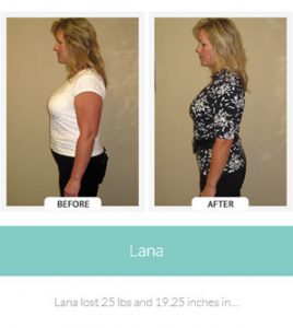 chirothin before and after photos lana